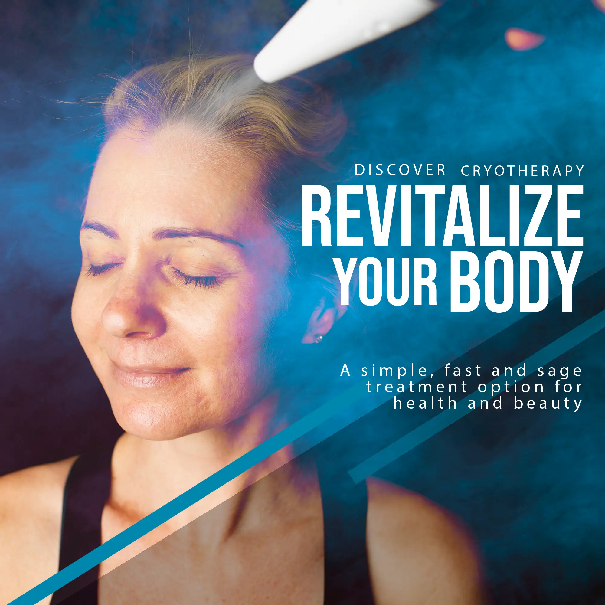 Frotox Facial Results