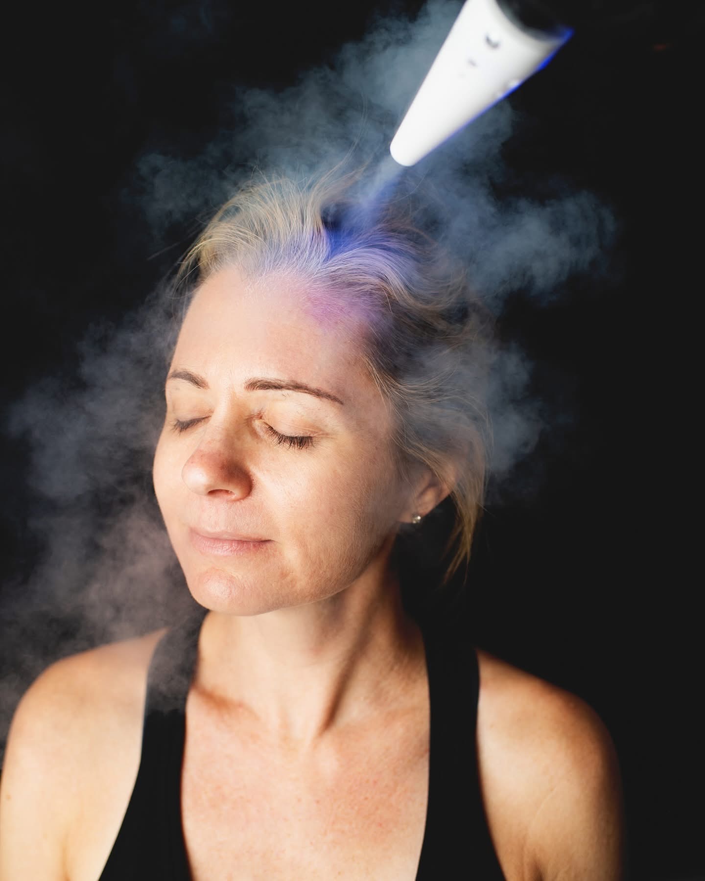 Hair Rejuvenation Results